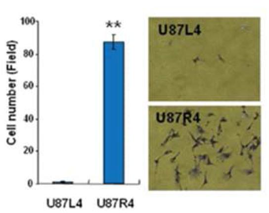 U87MG L4와 R4 세포의 migration 비교