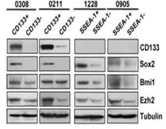 cancer stem cell marker +/- cell에서 EZH2 발현