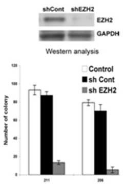 GSCs의 clonogenicity에 미치는 EZH2의 영향.