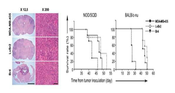확립한 MDA-MB-435 Br4 뇌전이 암줄기세포 충만화 세포주의 종양형성 능력 확인
