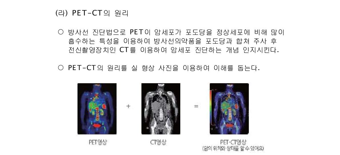 PET-CT의 실형상 예