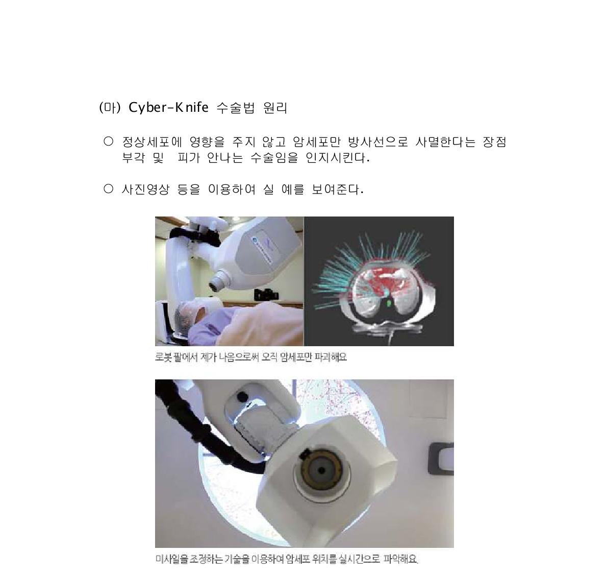 cyber-knife실 예