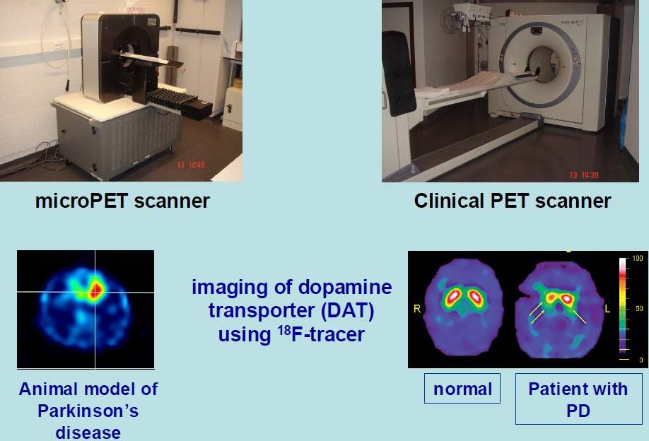 소동물(좌) 및 임상용 PET장비(우)에서 획득한 방사성의약품을 이용한 분자기능영상