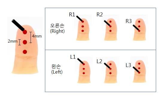 손가락 당 4mm 간격으로 표시된 세 가지 위치