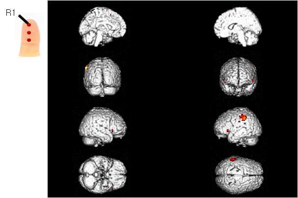 피험자의 오른손 검지 첫 번째 위치(R1)에 가벼운 압력의 촉각 자극을 제시하였을 경우 이에 반응하는 뇌의 활성 영역