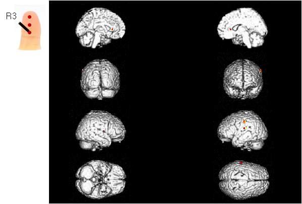 피험자의 오른손 검지 세 번째 위치(R3)에 가벼운 압력의 촉각 자극을 제시하였을 경우 이에 반응하는 뇌의 활성 영역