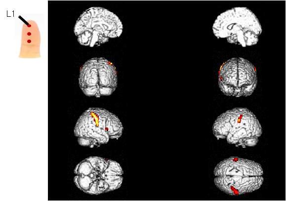 피험자의 왼손 검지 첫 번째 위치(L1)에 가벼운 압력의 촉각 자극을 제시하였을 경우 이에 반응하는 뇌의 활성 영역