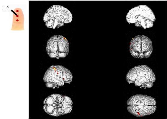 피험자의 왼손 검지 두 번째 위치(L2)에 가벼운 압력의 촉각 자극을 제시하였을 경우 이에 반응하는 뇌의 활성 영역