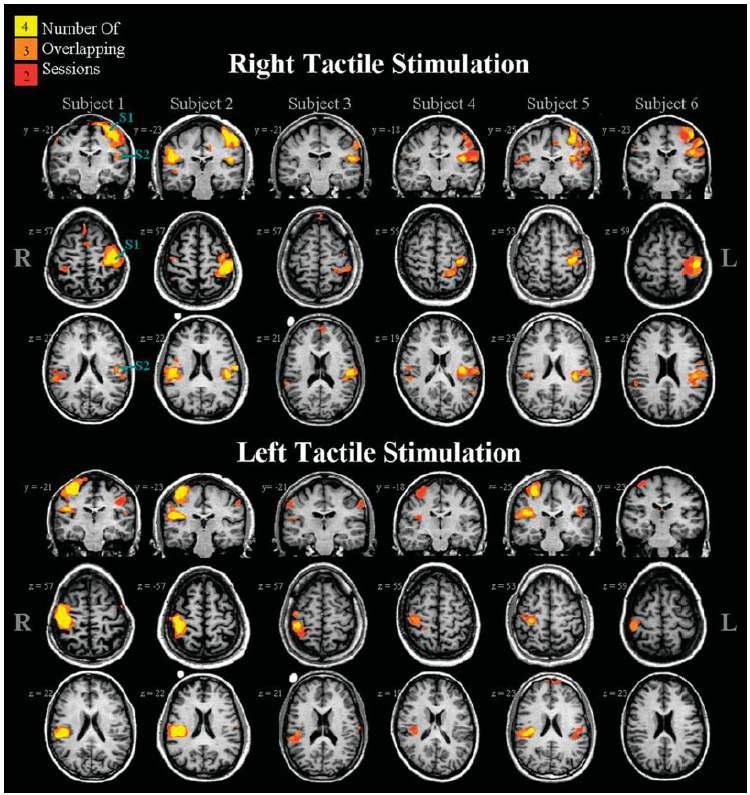 왼쪽 손과 오른쪽 손에 brush를 통한 가벼운 압력의 촉각 자극을 제시하였을 경우 이에 대한 뇌의 활성 영역