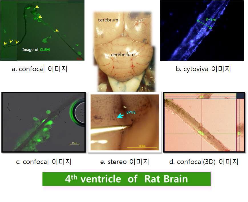 Brain 4뇌실의 CSF가 흐르는 공간에서 발견한 프리모시스템의 실체와 현미경사진.