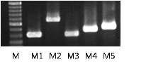 프리모시스템 조직에서 발현된 다양한 무스카린수용체들의 Gel images (PCR product).