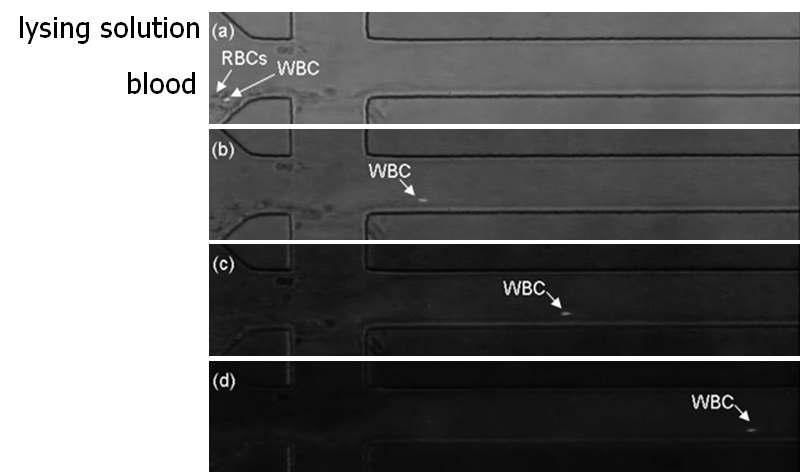 미세유동성 기반의 실시간 면역세포 분리 기술. 미세관 내에 전혈 시료와 적혈구 용혈 시약을 도입하고 빠르게 섞어줌으로써 면역세포만을 걸러 낼 수 있음