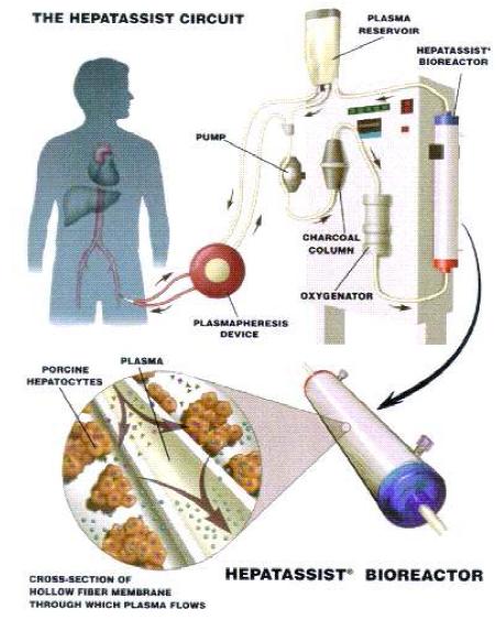 Bio-Artificial liver system