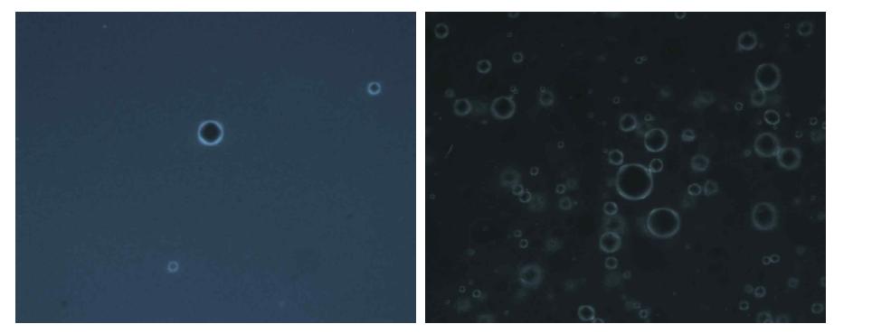 제형내 포함된 리포좀의 편광현미경 촬영