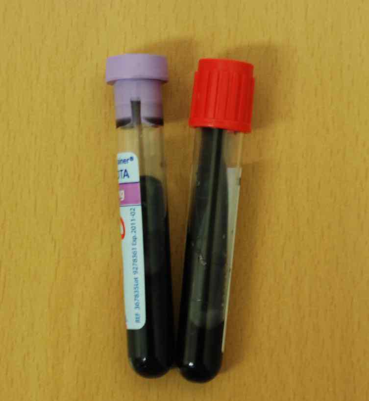 EDTA Vacutainer 및 Plain Vacutainer