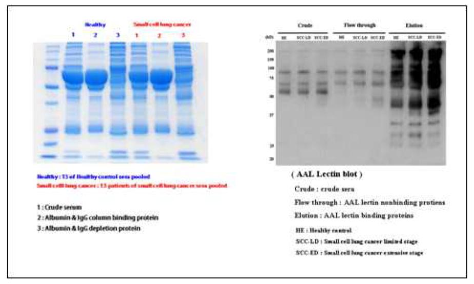 Albumin & IgG depletion and Fucosylated glycoprotein enrichment from serum