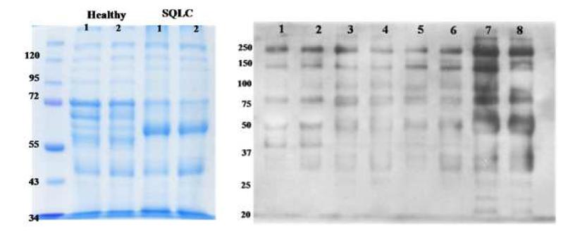 MS/Ms 분석을 위해 1DE-separation을 실시한 Gel과 Enrichment를 검증한 lectin blot.