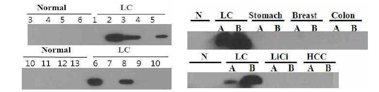 다양한 샘플에 대한 western blot analysis