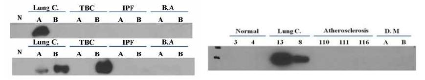 다양한 샘플에 대한 western blot analysis