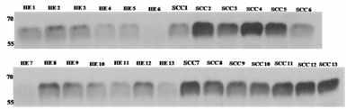 정상인과 폐암환자에 대한 western blot analysis