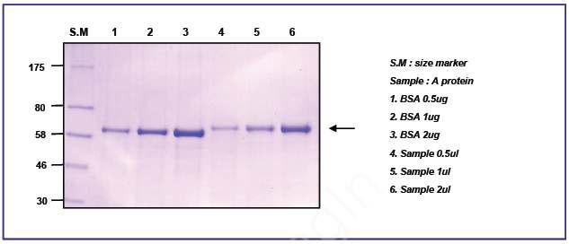 SAA antigen의 Purity 확인