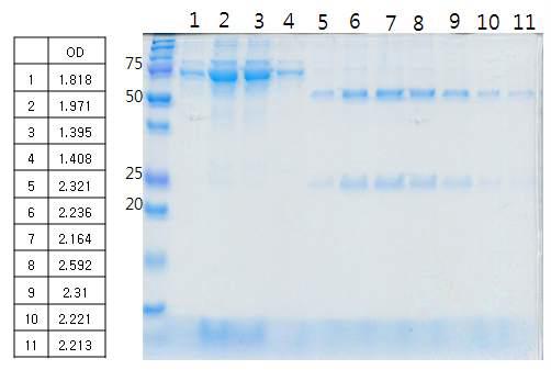 The pattern of protein G purified of 10G1 Ascties by SDS-PAGE