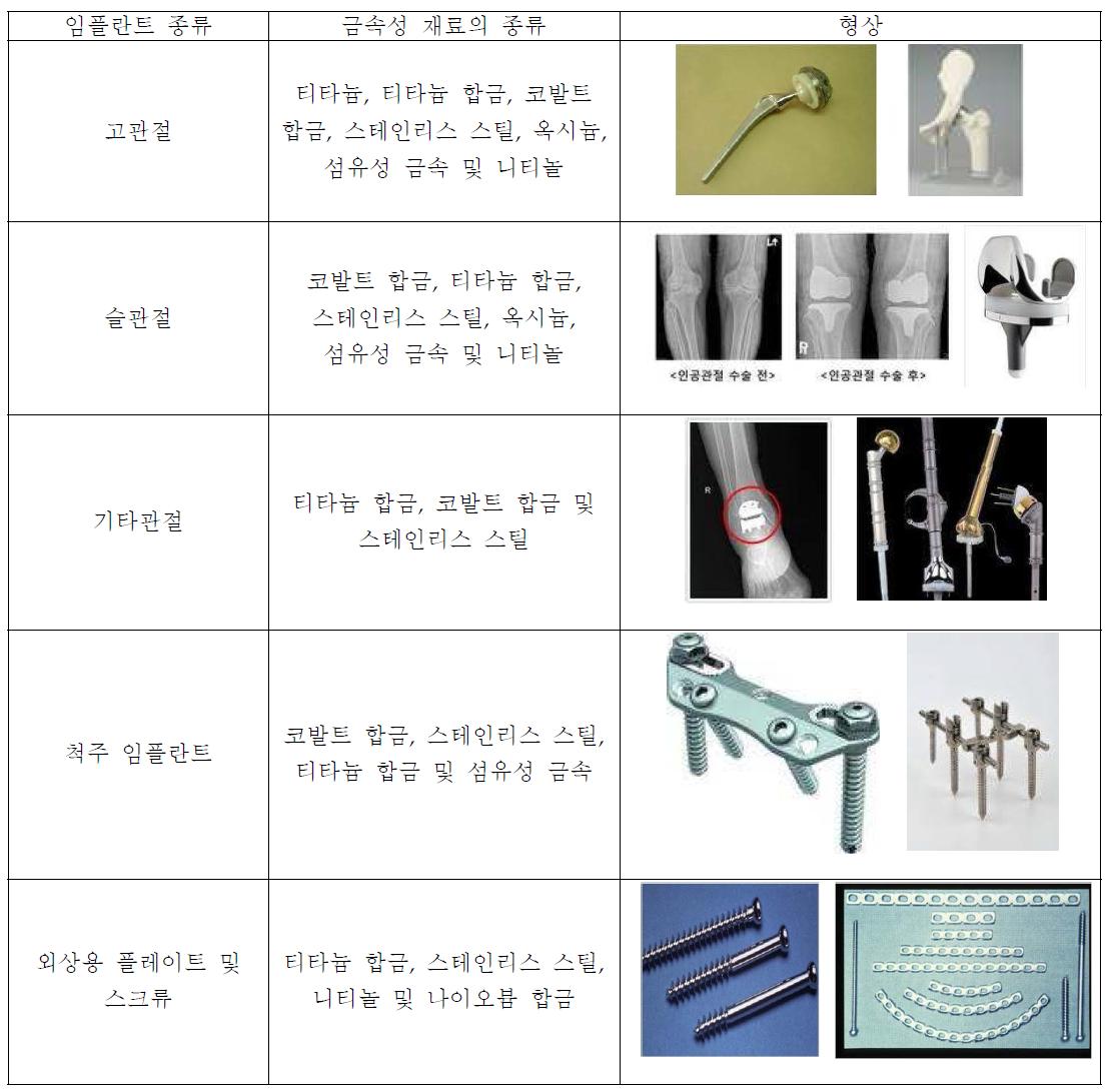 금속 재료의 각 부위별 사용종류