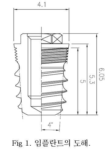 Diagram of implant