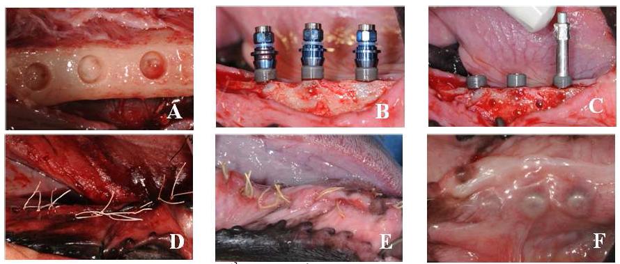 Implant surgery.