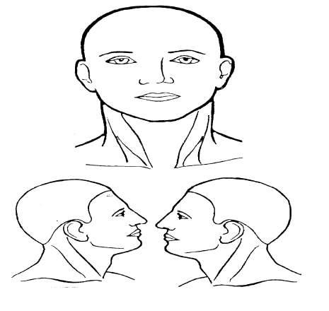 점막피부 변화의 부위를 기술하기 위한 얼굴 전면, 우측, 좌측 면 그림