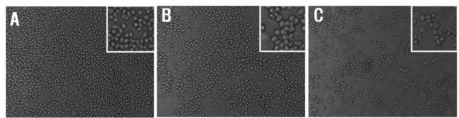 BV 2 microglia cell morphology.