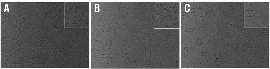 C6 glioma cell morphology.