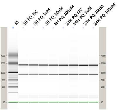 RNA Migration pattern (electrophoretic trace). M; RNA size marker.