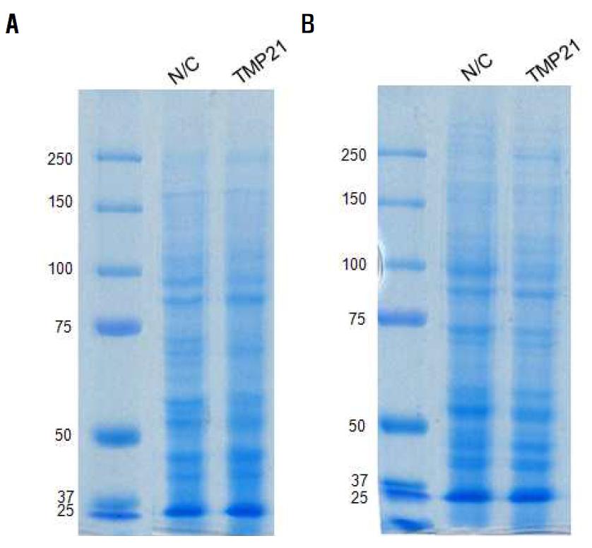 SDS-PAGE 12% 젤, Coomassie blue 염색에서 TMP21 유전자가 도입된 BV-2 microglia 세포(A) 와 C6 glioma 세포(B)의 단백질 확인