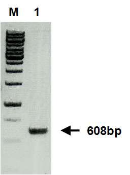 p22-FLIP 유전자의 RT-PCR 증폭산물