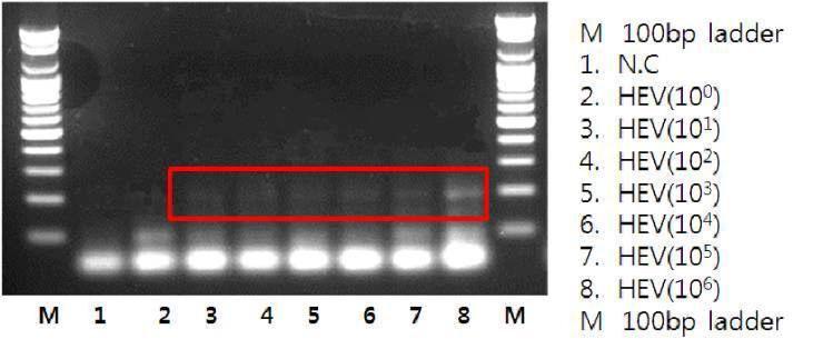 HEV RT-PCR
