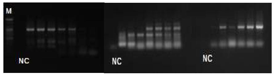 HEV RT-PCR used to CAU primer.