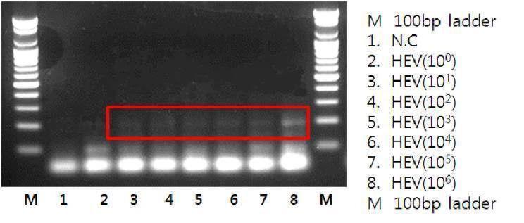 HEV RT-PCR