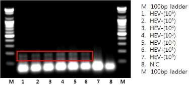 HEV 농도별 Nested RT-PCR 최적화