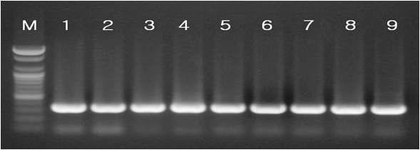 HEV RT-PCR used to universal primer.