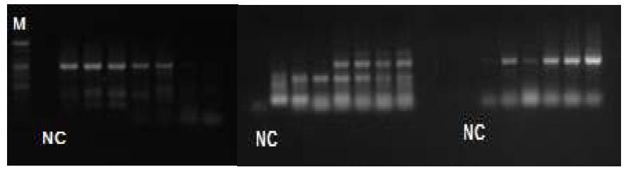 HEV RT-PCR used to CAU primer.