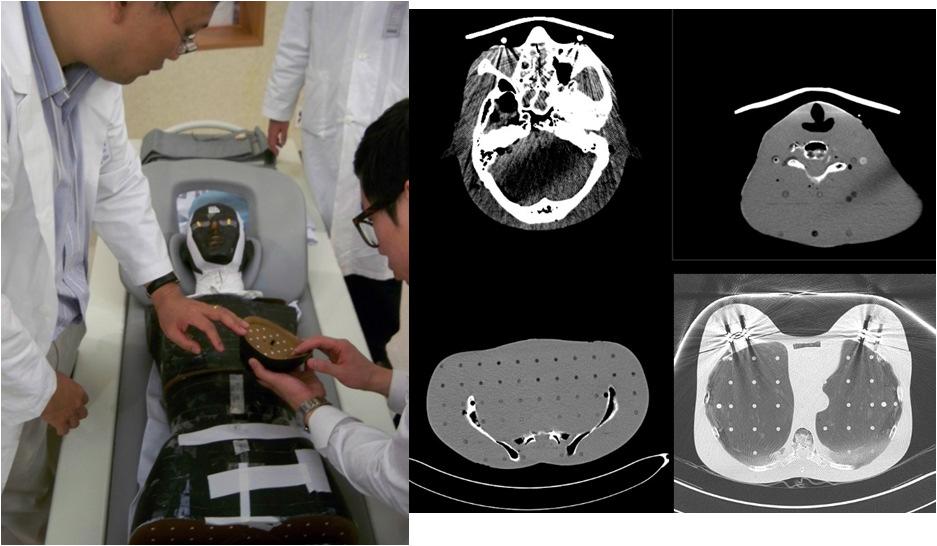 Rando 팬텀 실험 장면(좌)과 촬영시 CT영상