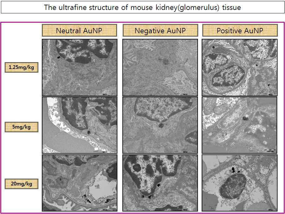 신장(사구체)조직의 투과전자현미경 사진