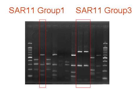 Fig. 3-1-4. Restriction pattern analyses after whole genome amplification and 16S rRNA gene PCR.