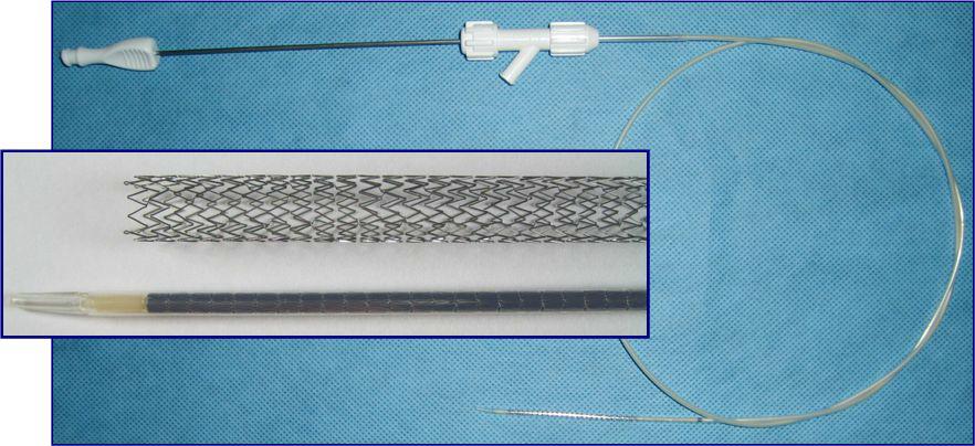 Laser 가공 stent와 카테터에 로딩한 모습