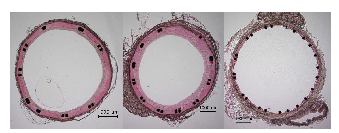 Group 2. Minipig 의 right CCA 에 Control vs Polymer1 vsPTX1 (좌측부터) coated stent 삽입 후 1개월 후 H&E 염색소견.