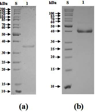 SDS-PAGE of the purified XylK (a) and XylK1 (b).