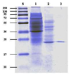 SDS-PAGE of the purified rXylP.