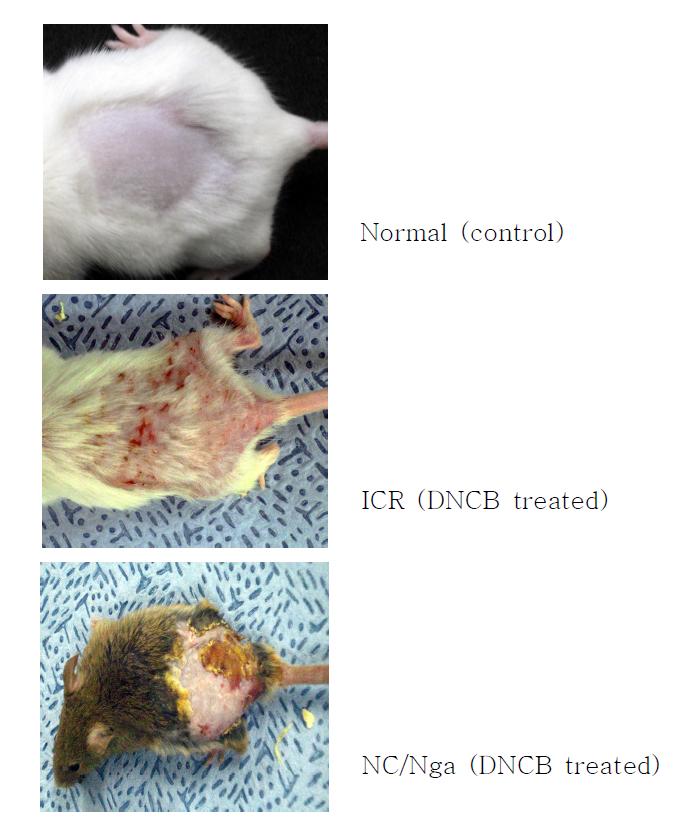 IcR 마우스 및 Nc/Nga 마우스의 아토피성 피부염 유발 (사진)