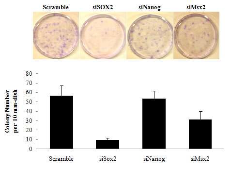 RNA 간섭에 의한 중간엽 줄기세포의 콜로니 형성능력의 감소.